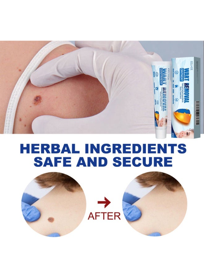 إيلهو مرهم لإزالة الثآليل، مكونات طبيعية لعلاج آمن لثآليل الجسم وحب الشباب والشامات وتقليل الندبات، يزيل الثآليل والشامات وينعم البشرة. - Image 3